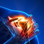 SPORTVERLETZUNG Schwimmerschulter durch mangelnde Kraultechnik © AdobeStock / sugarandpain.com